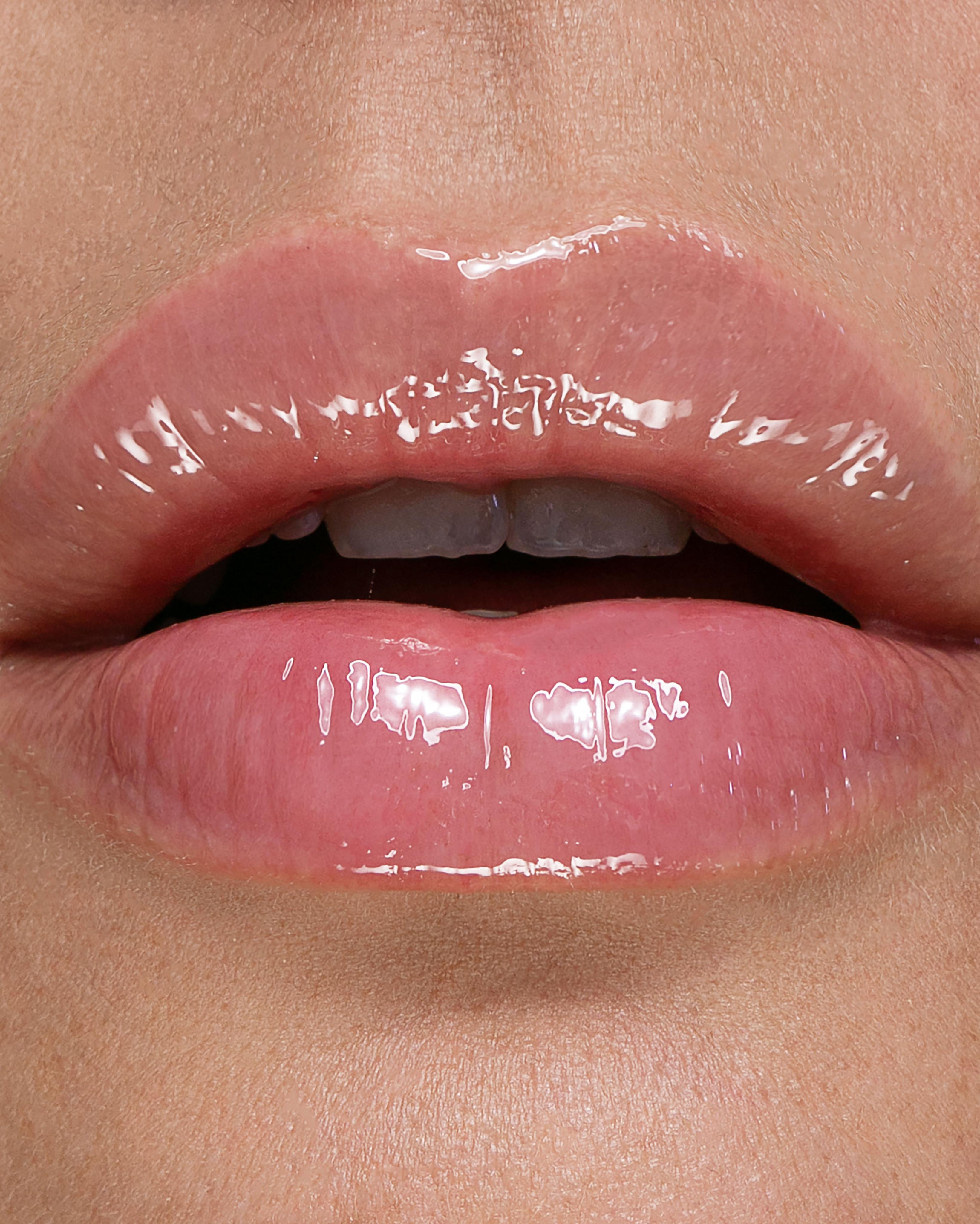 /_next/static/media/open_lips.d8a259ea.jpeg